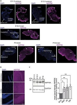 Knockdown of INPP5K compromises the differentiation of N2A cells